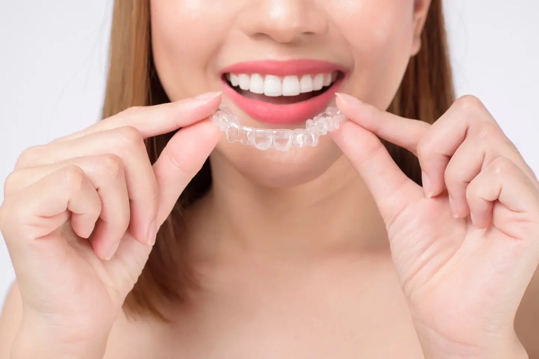A woman fitting a clear aligner