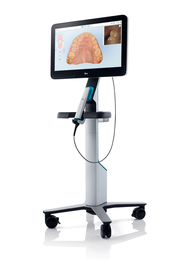 iTero digital impression scanner