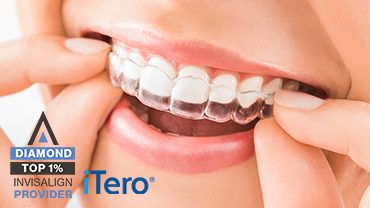 Clear aligner being fitted, with Diamond Top 1% Invisalign Provider and iTero logos