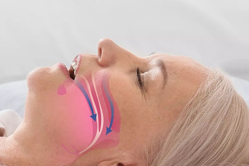 A sleeping woman with her airway illustrated in pink